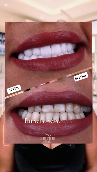 شهادة فيديو: ألكسندرا