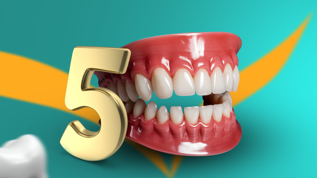 Top 5 Benefits of Professional Teeth Whitening