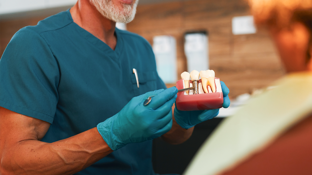 Dental-Implants