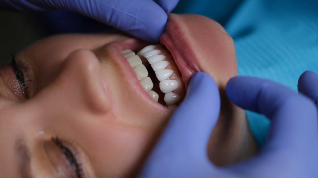 dental tourism in Turkey