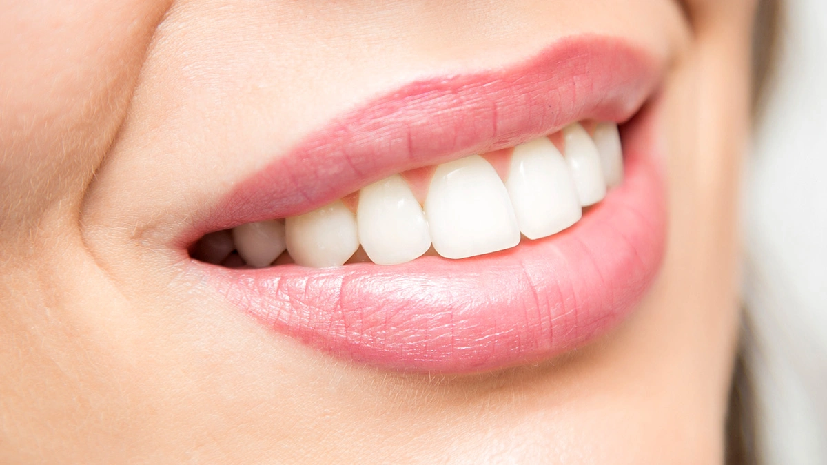 Hollywood Smile in Turkey (2026): Common Risks and Misconceptions Explained