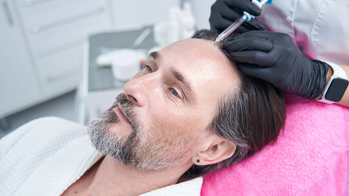 Hair Transplant Turkey 2026: Why Turkey Leads the World (FUE, DHI, Sapphire & Costs Explained)