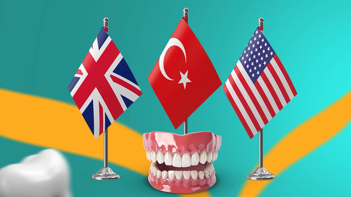 Hollywood Smile in Istanbul vs UK & USA: Cost, Quality, and Results
