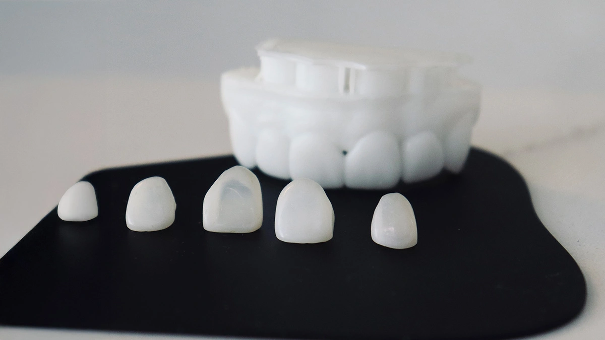 Veneers Price in Turkey 2026: Cost per Tooth in Istanbul