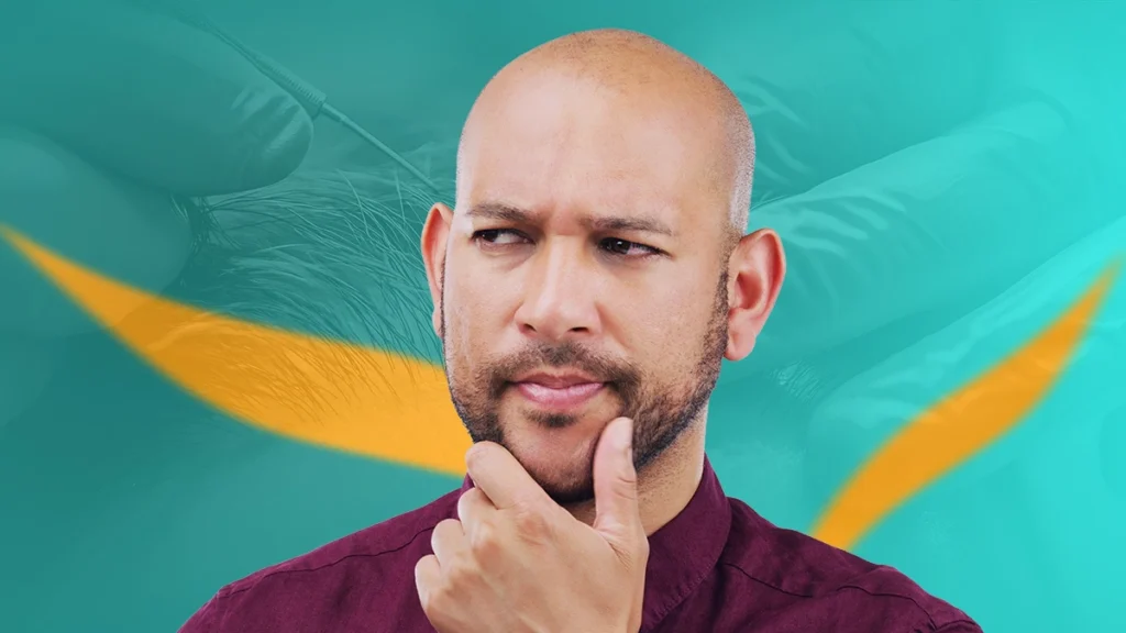 Who Is a Good Candidate for a Hair Transplant in 2026_