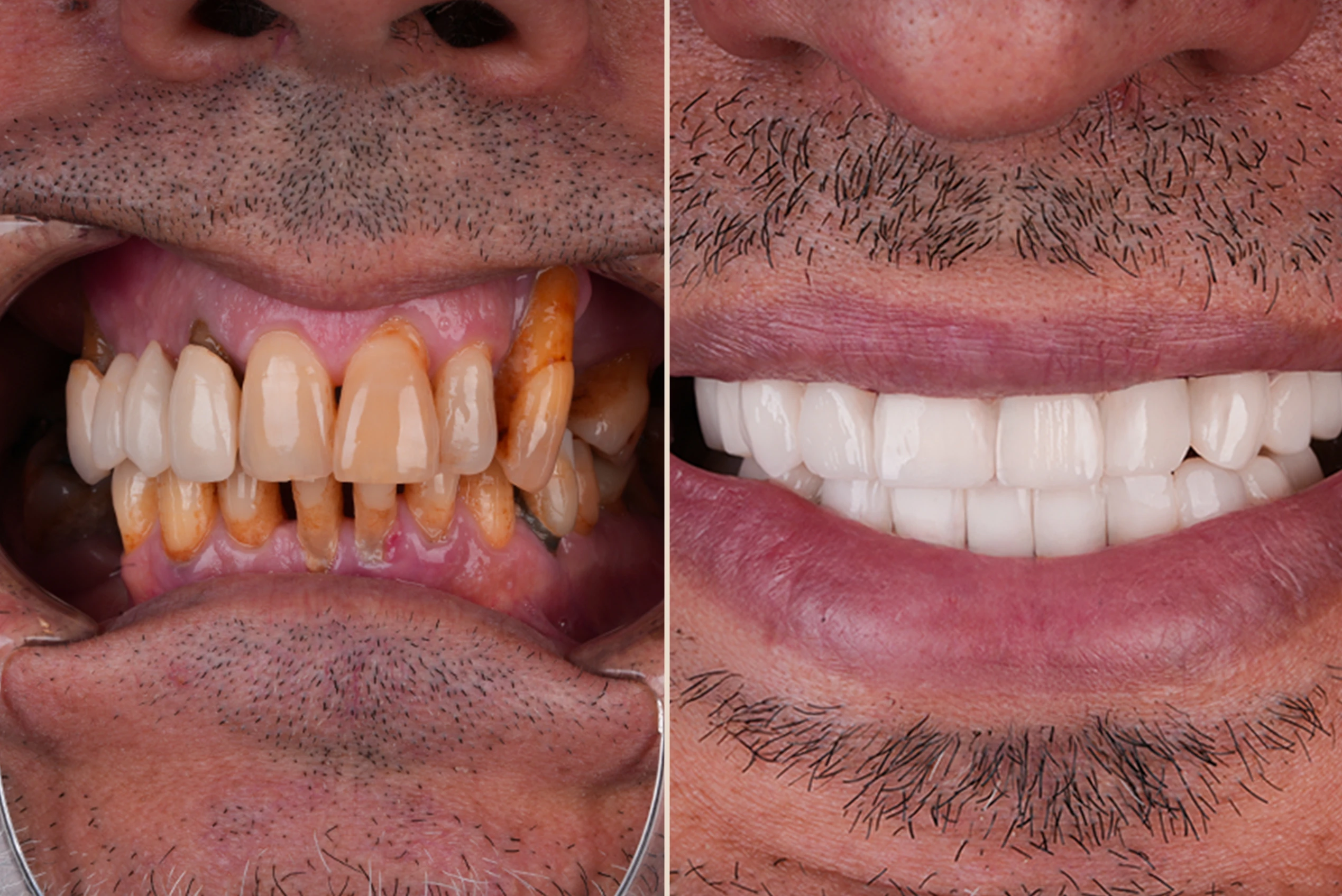 Gallery Before & After copy