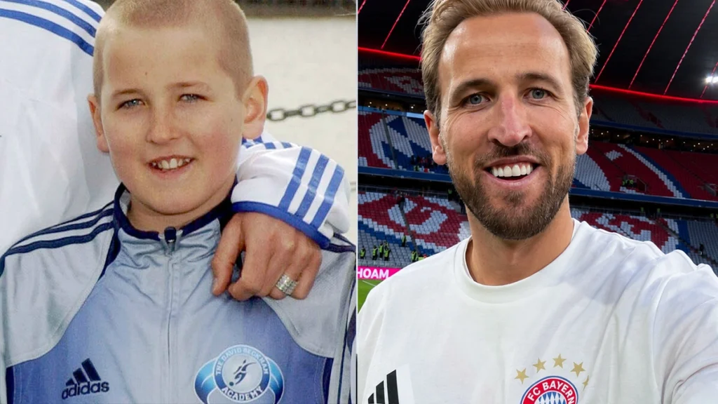Harry Kane smile before and after photo comparison from childhood to adulthood