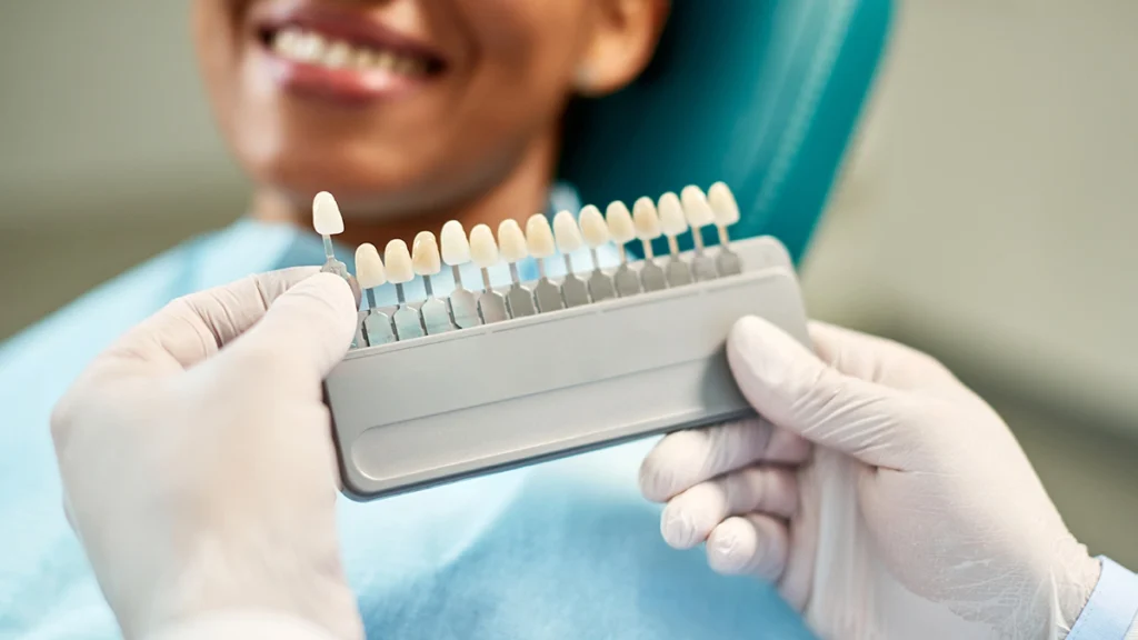 Dentist showing a veneer shade guide to a patient while selecting the best veneer color for a natural smile.