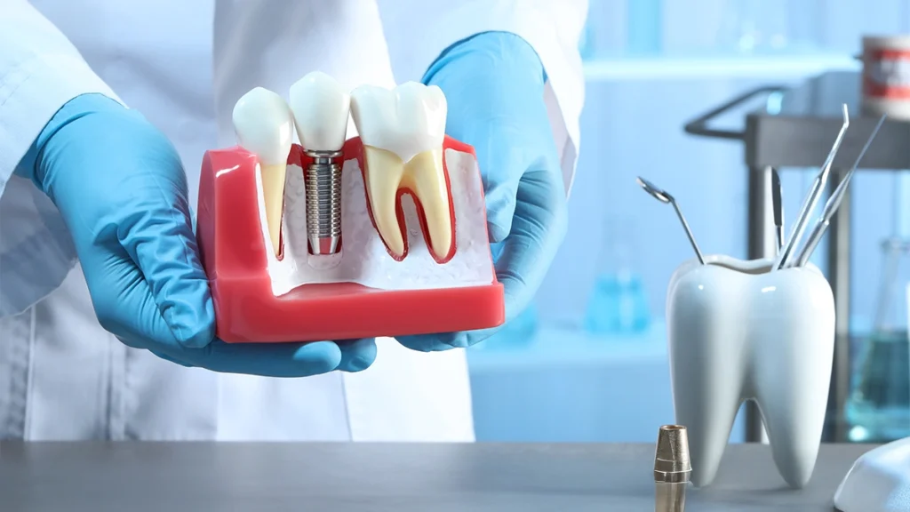 Dental Implants and Medical Conditions in Turkey 2026: Safety, Risks & Treatment Guide