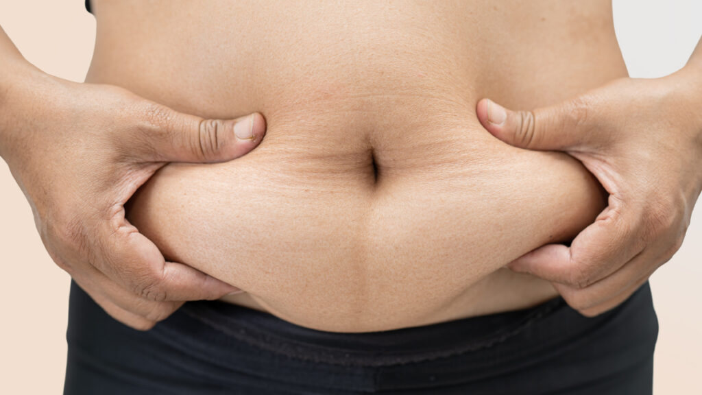 Liposuction vs Tummy Tuck