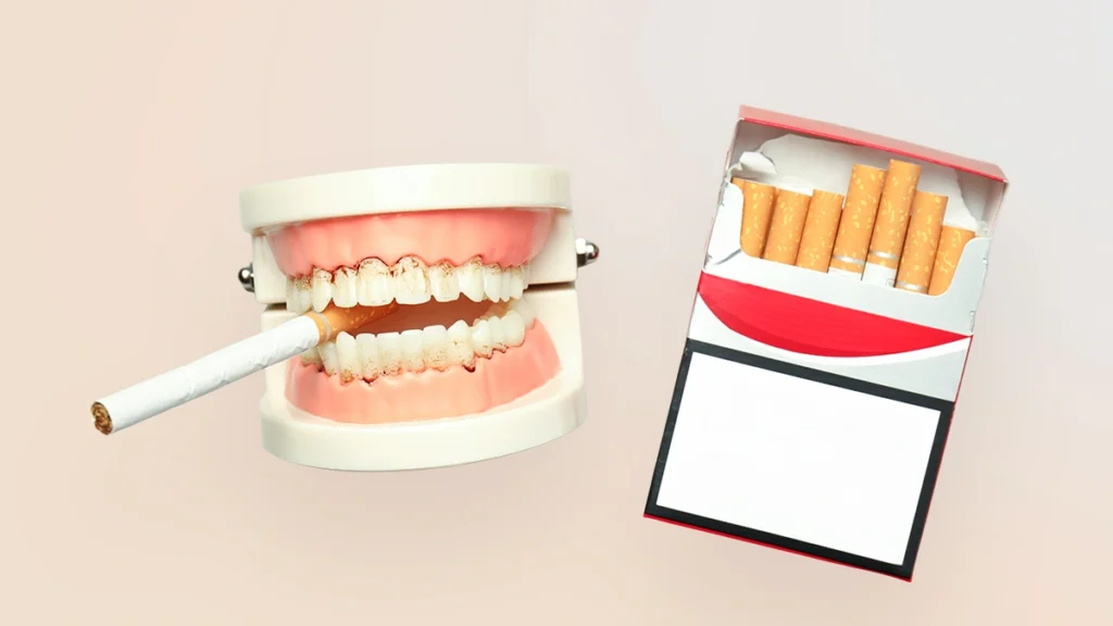 Smoking and dental implants risk shown with cigarette and dental model