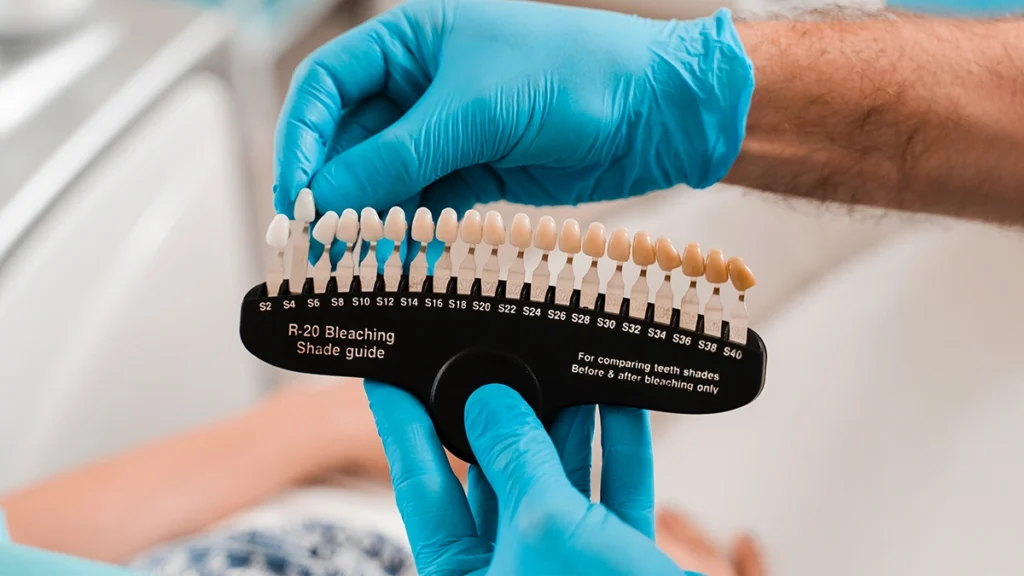 Dentist holding a veneer shade guide to compare natural veneer colors for a brighter, more balanced smile.