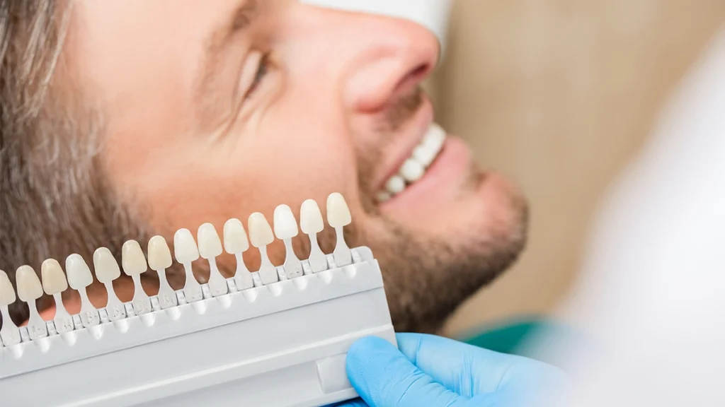 Dentist using a veneer shade guide to choose the best veneer color for a patient’s skin tone and natural smile.