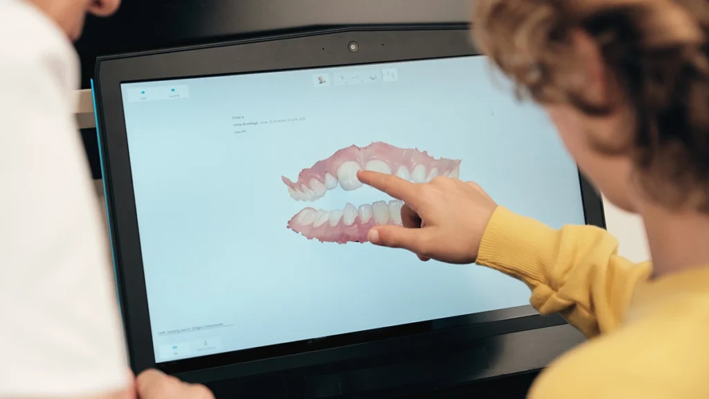 Digital bite analysis for dental implant planning in a bruxism patient