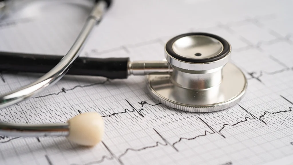 Stethoscope on an ECG report representing cardiac clearance for dental implants