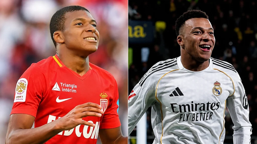 Kylian Mbappé smile before and after comparison from his early career to today