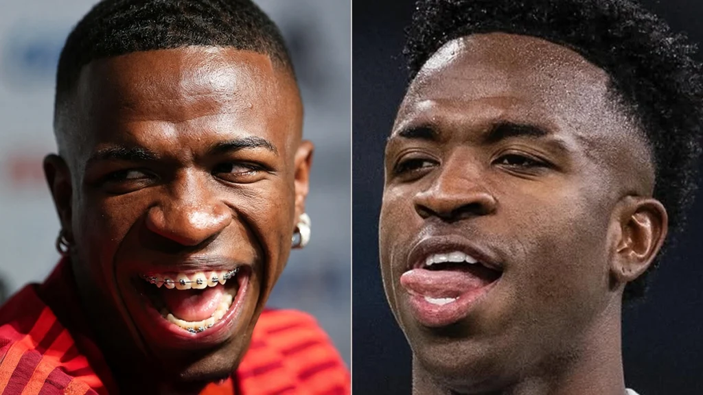 Vinícius Jr smile before and after with braces and later appearance