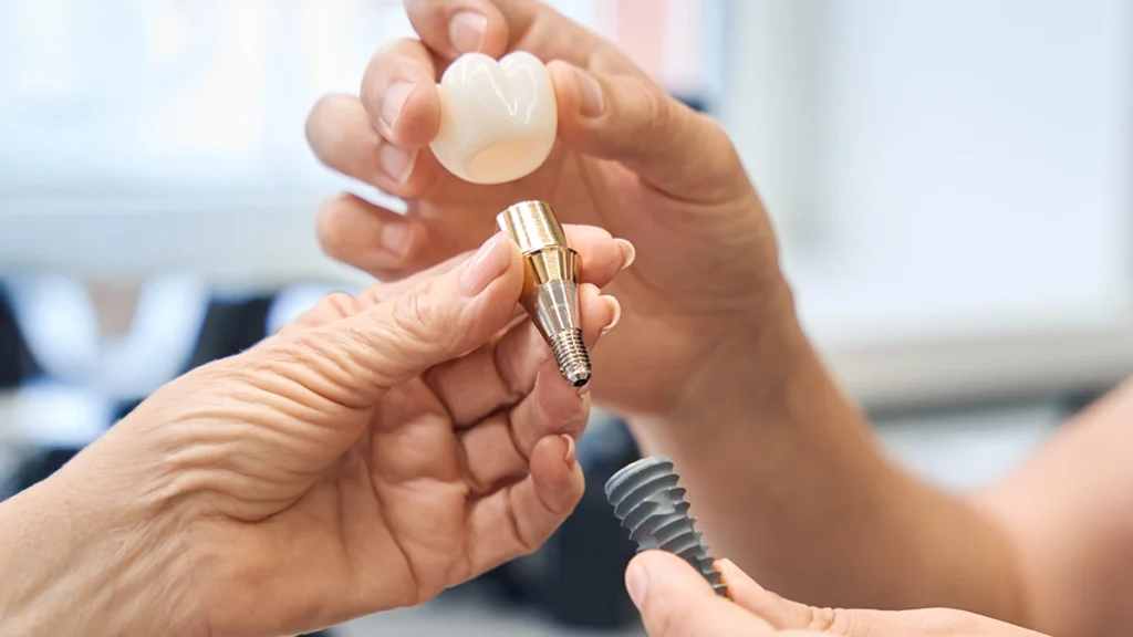 Dentist holding a dental crown and implant components during restorative dental treatment
