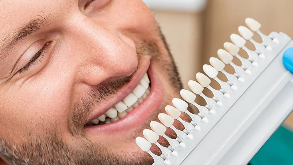 Smiling patient comparing teeth color with a dental shade guide after teeth whitening