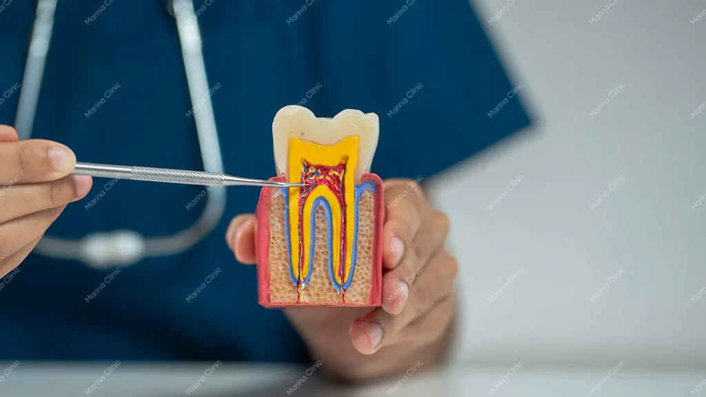 Dentist pointing to a tooth anatomy model showing the root canal, pulp, and tooth structure during dental treatment planning.
