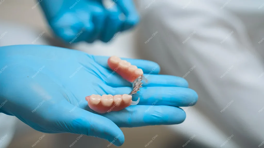 Dentist holding a removable dental prosthesis, illustrating restoration costs in the snap-on dentures vs All-on-4 comparison.
