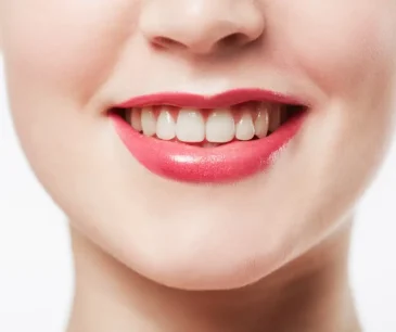 Hollywood Smile in Turkey